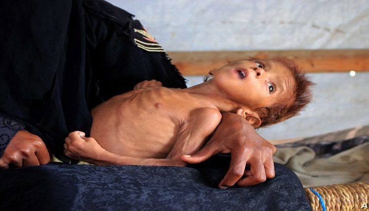 الأمم المتحدة- اليمن